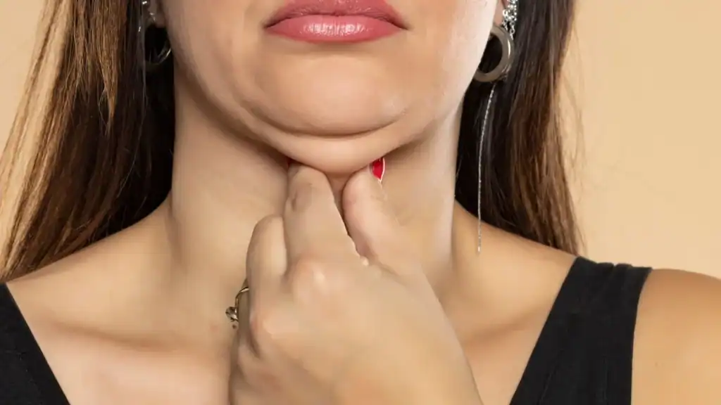 An image of a woman with double chin, sad, worried : Non Surgical Double Chin Removal Treatment in Thames Ditton, UK