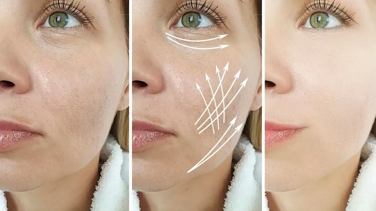 Can One Treatment Really Tackle More Than One Skin Concern Thames Ditton?