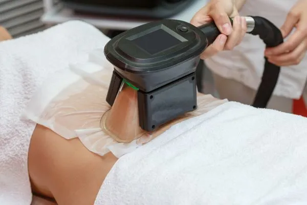 Image of person having fat freezing treatment to help weight gain Thames Ditton