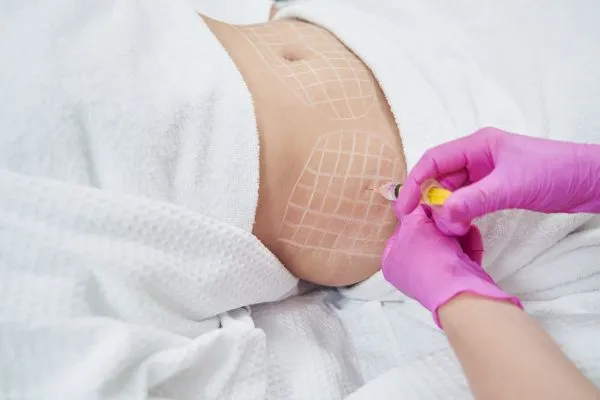 image of fat dissolving injections on love handles to help combat weight gain Thames Ditton