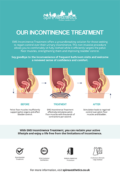image to show how EMS treatment works for female urinary incontinence Thames Ditton