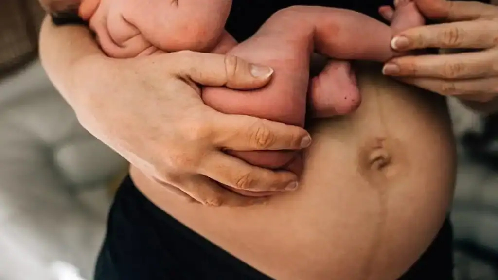 Why Is My Stomach Still Big After Pregnancy Thames Ditton?